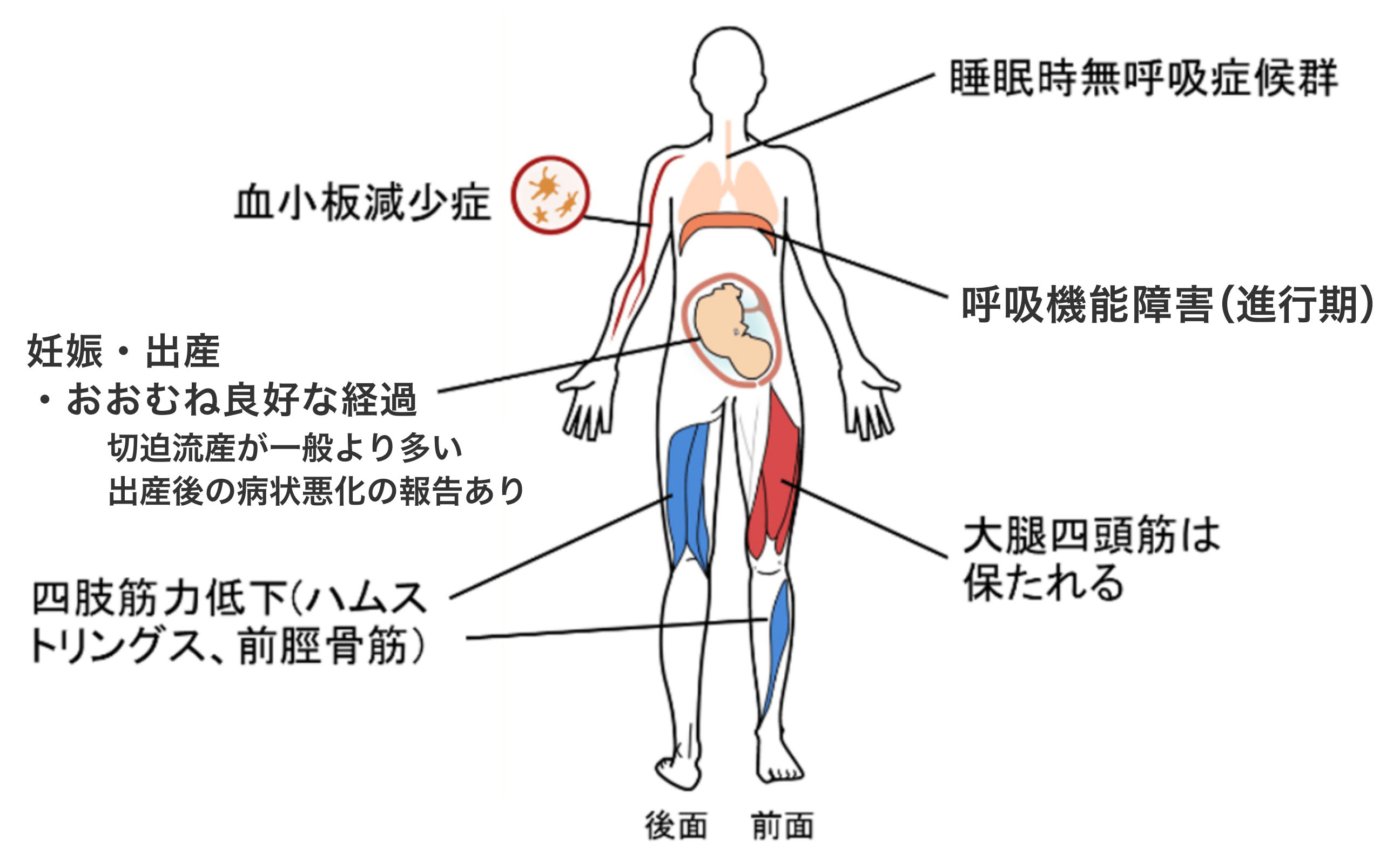部位図