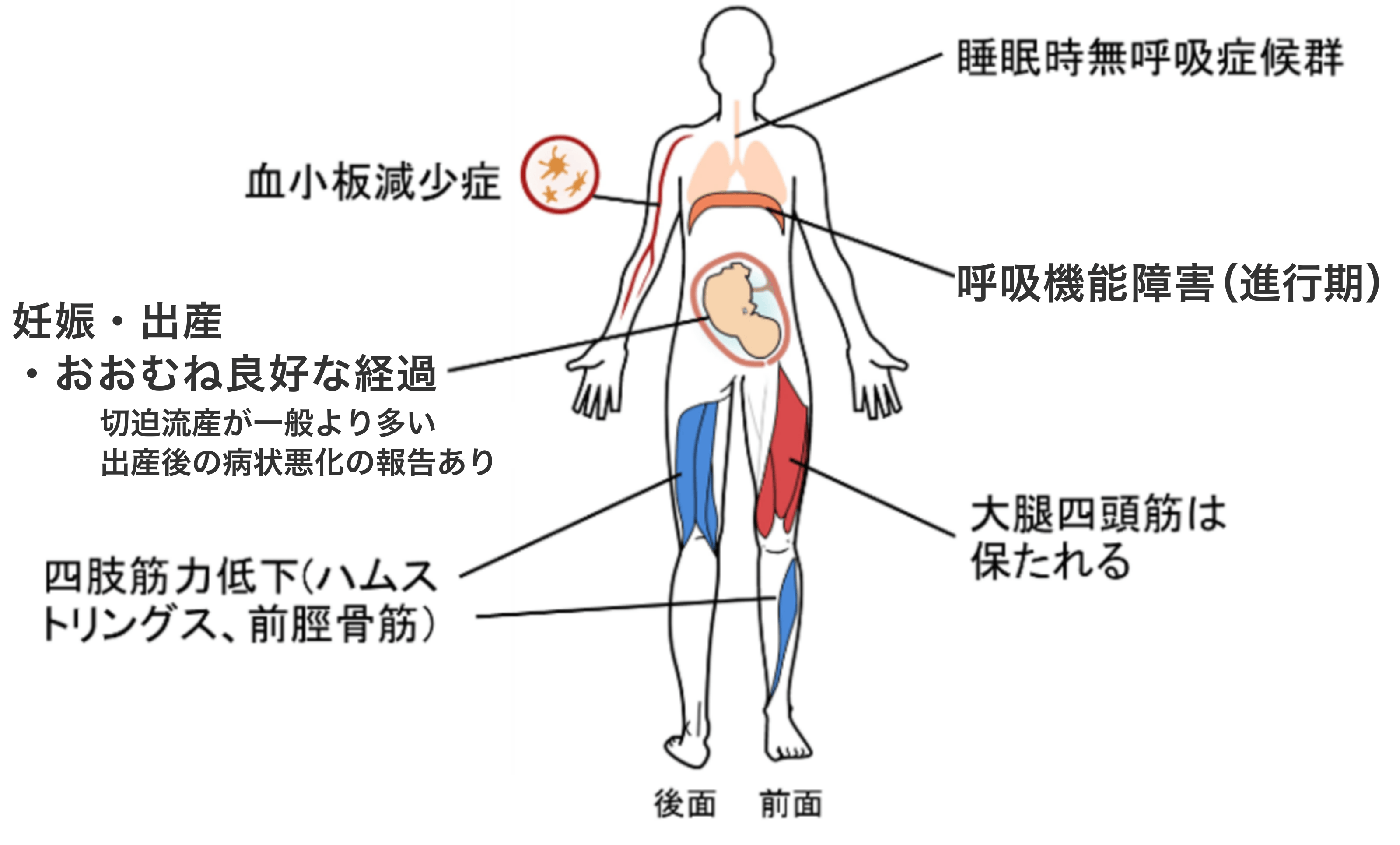 部位図