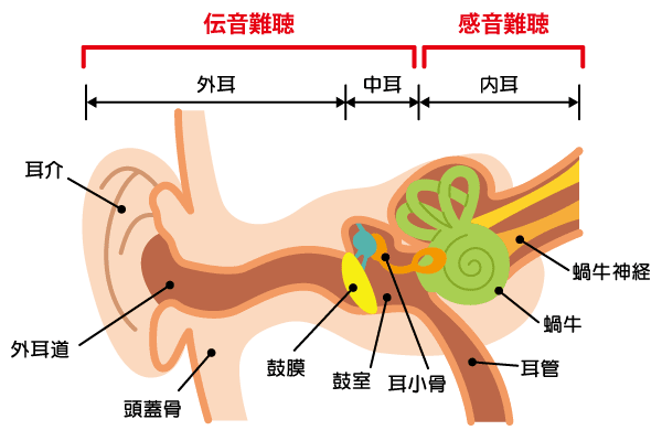 鼓膜穿孔 音が聞こえにくい もしかして難聴かも 一般 患者の皆さま ノーベルファーマ株式会社