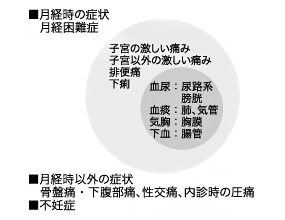 月経困難症の症状図解