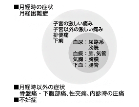 月経困難症の症状図解