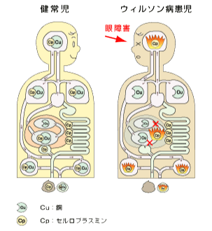 眼障害の図解